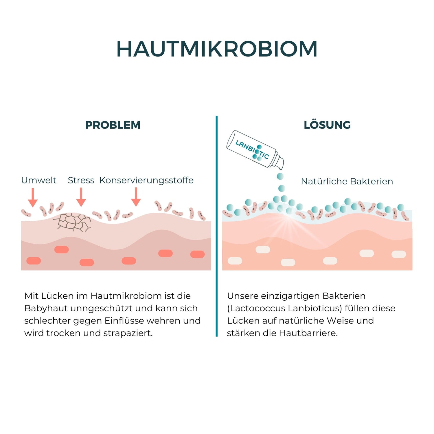 Lipid Care Baby - Pflegecreme für Babys mit Neurodermitis