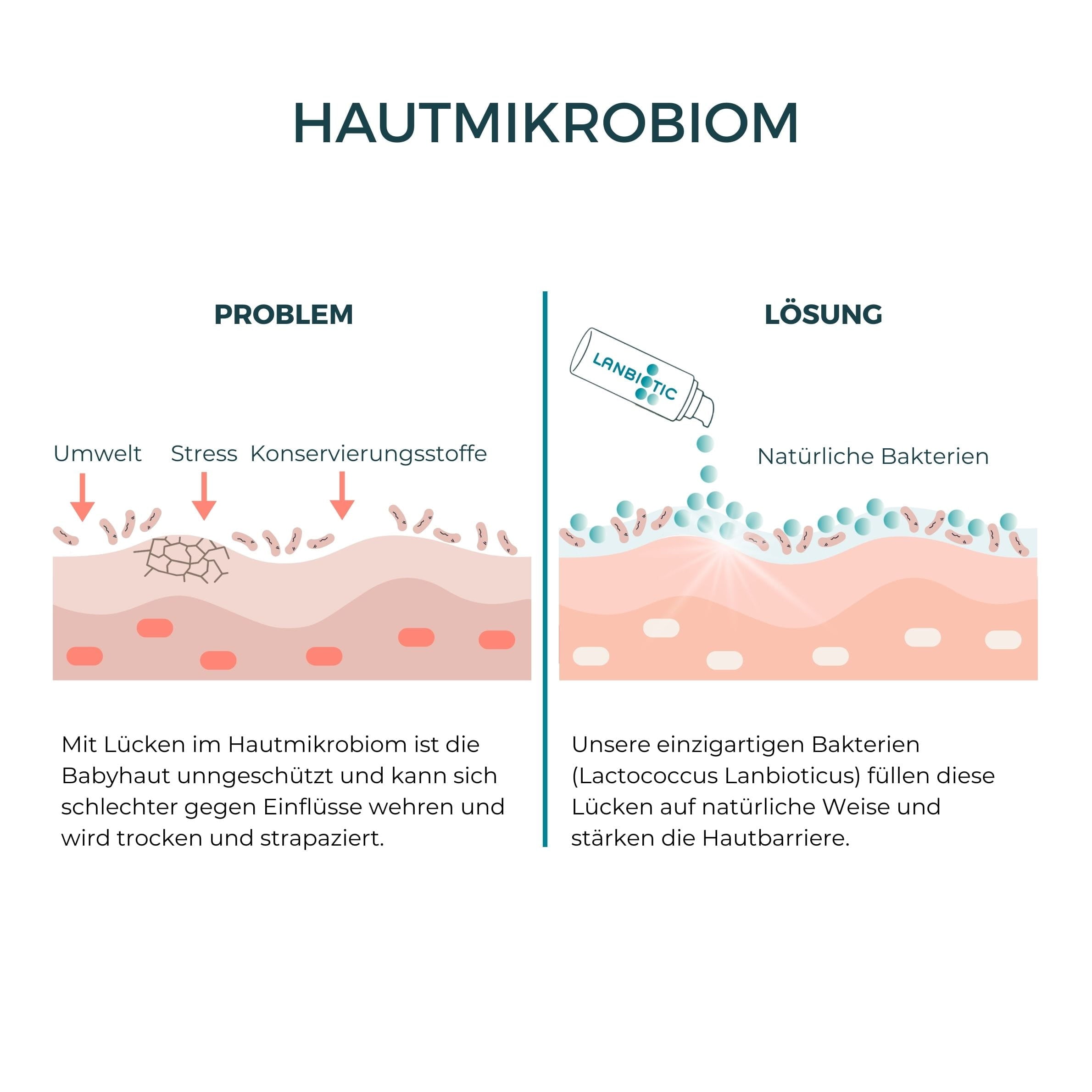 Lipid Care Baby - Pflegecreme für Babys mit Neurodermitis