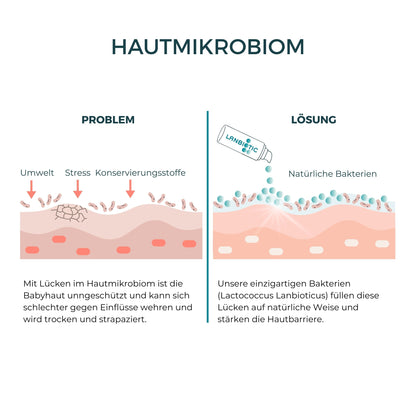 Lipid Care Baby - Pflegecreme für Babys mit Neurodermitis