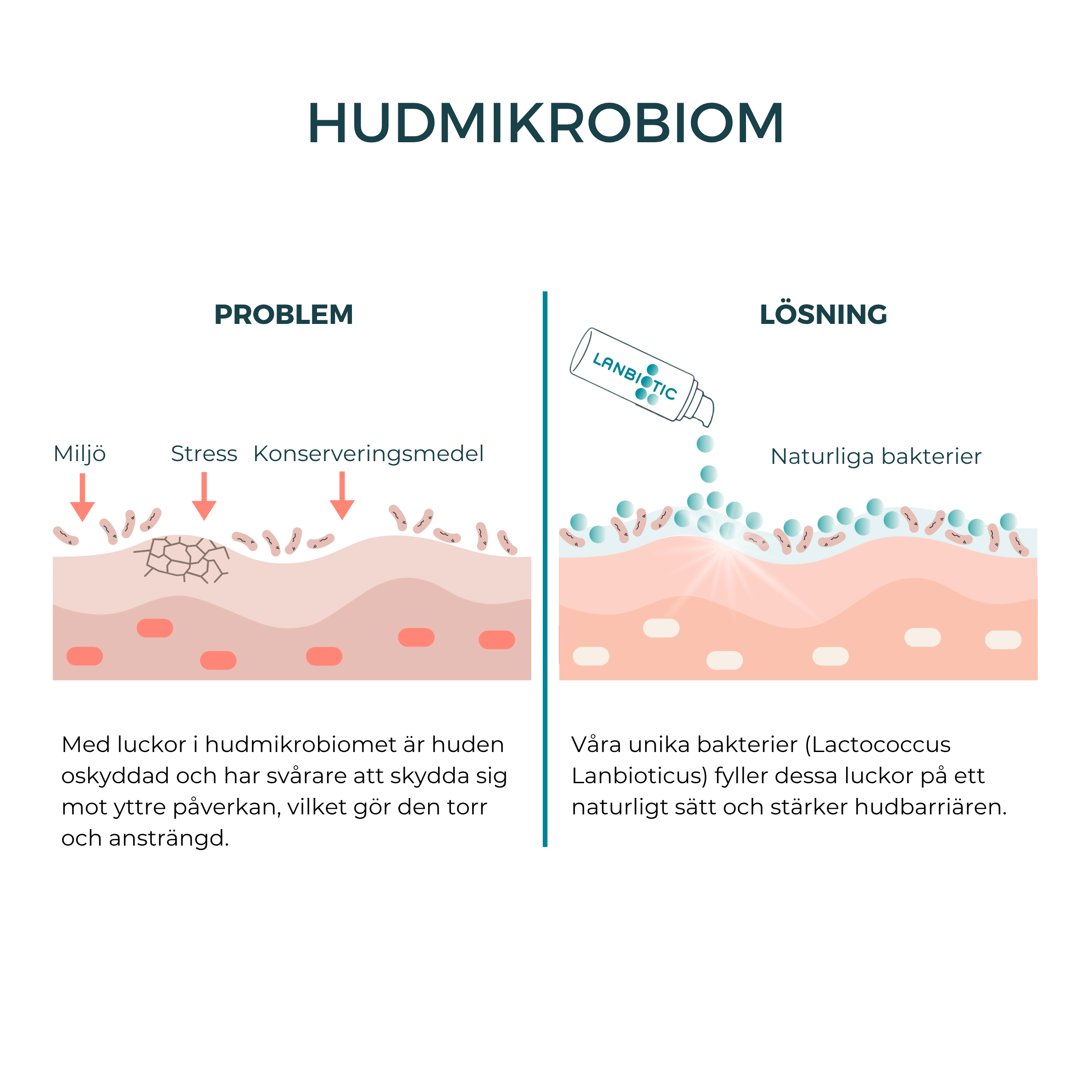Lipid Care - probiotisk vårdande kräm för atopisk dermatit